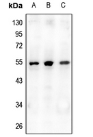 Rabbit anti Osteoprotegerin Polyclonal Antibody 爱必信 absin 官网