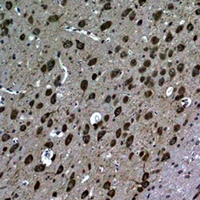 Rabbit anti-LC3B Polyclonal Antibody