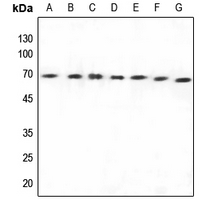 Rabbit anti-Arylsulfatase E Polyclonal Antibody