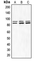 Rabbit anti-Phospho-IKK α/β(Ser180/181) Polyclonal Antibody
