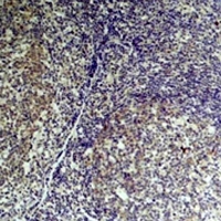 Mouse anti-TNF-α Monoclonal Antibody