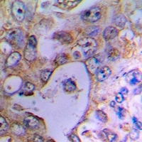 Rabbit anti-UCP2 Polyclonal Antibody