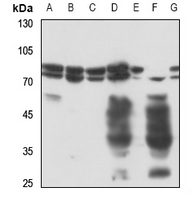 Rabbit anti-Radixin Polyclonal Antibody