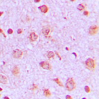 Rabbit anti-PFKP Polyclonal Antibody