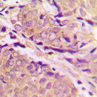 Rabbit anti-PFKM Polyclonal Antibody