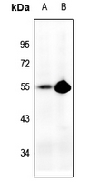 Rabbit anti-p53 Polyclonal Antibody