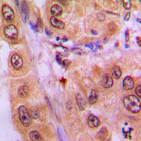 Rabbit anti-Phospho-STAT3(Tyr705) Polyclonal Antibody