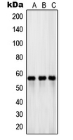 Rabbit anti-EAAT3 Polyclonal Antibody
