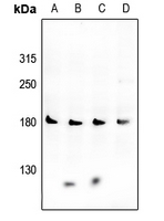 Rabbit anti-VEGFR2 Polyclonal Antibody