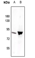 Rabbit anti-Phospho-STAT3(Tyr705) Polyclonal Antibody