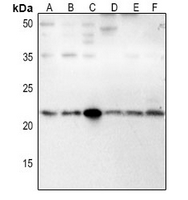 Rabbit anti-IFN-β Polyclonal Antibody