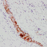 Mouse anti-NEFL Monoclonal Antibody