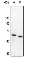 Rabbit anti-PRKAR2B Polyclonal Antibody