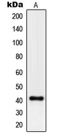 Rabbit anti-Pepsin A Polyclonal Antibody