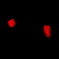 Rabbit anti-TPP2 Polyclonal Antibody