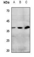 Rabbit anti-IP Receptor Polyclonal Antibody