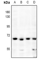 Rabbit anti-NF-kappaB p65 Polyclonal Antibody