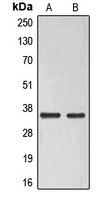 Rabbit anti-ELOVL6 Polyclonal Antibody