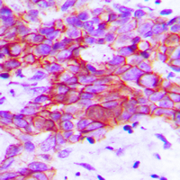 Rabbit anti-VEGFR2 Polyclonal Antibody