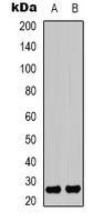 Rabbit anti-HMGB1(AcK12) Polyclonal Antibody