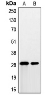 Rabbit anti-PSCA Polyclonal Antibody