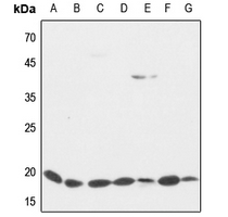 Rabbit anti-Cofilin Polyclonal Antibody