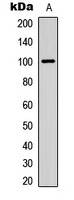 Rabbit anti-ITIH3 Polyclonal Antibody