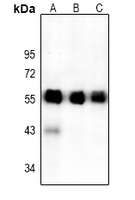 Rabbit anti-ATF4 Polyclonal Antibody