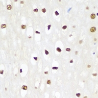 Rabbit anti-p62 Polyclonal Antibody