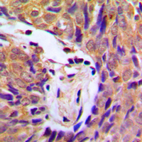 Rabbit anti-Phospho-IKK α/β(Ser180/181) Polyclonal Antibody