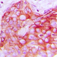 Rabbit anti-HER2 Polyclonal Antibody