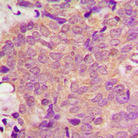 Rabbit anti-PPT Polyclonal Antibody