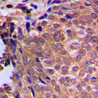 Rabbit anti-Cofilin Polyclonal Antibody