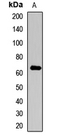Rabbit anti-Collagen 10α1 Polyclonal Antibody