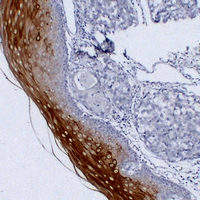 Mouse anti-Cytokeratin 4 Monoclonal Antibody