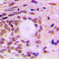 Rabbit anti-Cyclin F Polyclonal Antibody