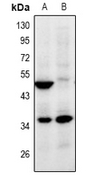 Rabbit anti-ZNF771 Polyclonal Antibody