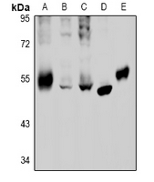Rabbit anti-GABRB2 Polyclonal Antibody