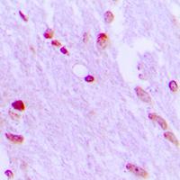 Rabbit anti-AIFM1 Polyclonal Antibody