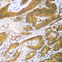 Rabbit anti-p53 Polyclonal Antibody