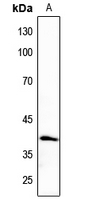 Rabbit anti-CK1α Polyclonal Antibody