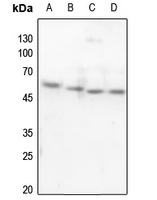 Rabbit anti-p53 Polyclonal Antibody