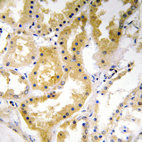 Rabbit anti-ABHD4 Polyclonal Antibody