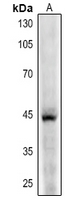 Rabbit anti-CD123 Polyclonal Antibody