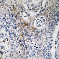 Rabbit anti-CD63 Polyclonal Antibody