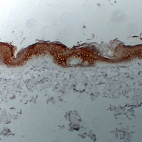 Mouse anti-Cytokeratin 1 Monoclonal Antibody