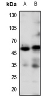 Rabbit Anti-2 Adrenergic Receptor Polyclonal Antibody Absin 优宁维(univ)商城