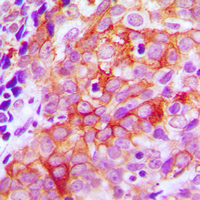 Rabbit anti-β-2 Adrenergic Receptor Polyclonal Antibody