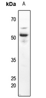 Rabbit anti-CD63 Polyclonal Antibody