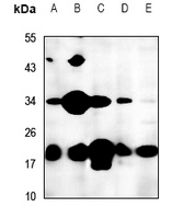 Rabbit anti-FTH1 Polyclonal Antibody